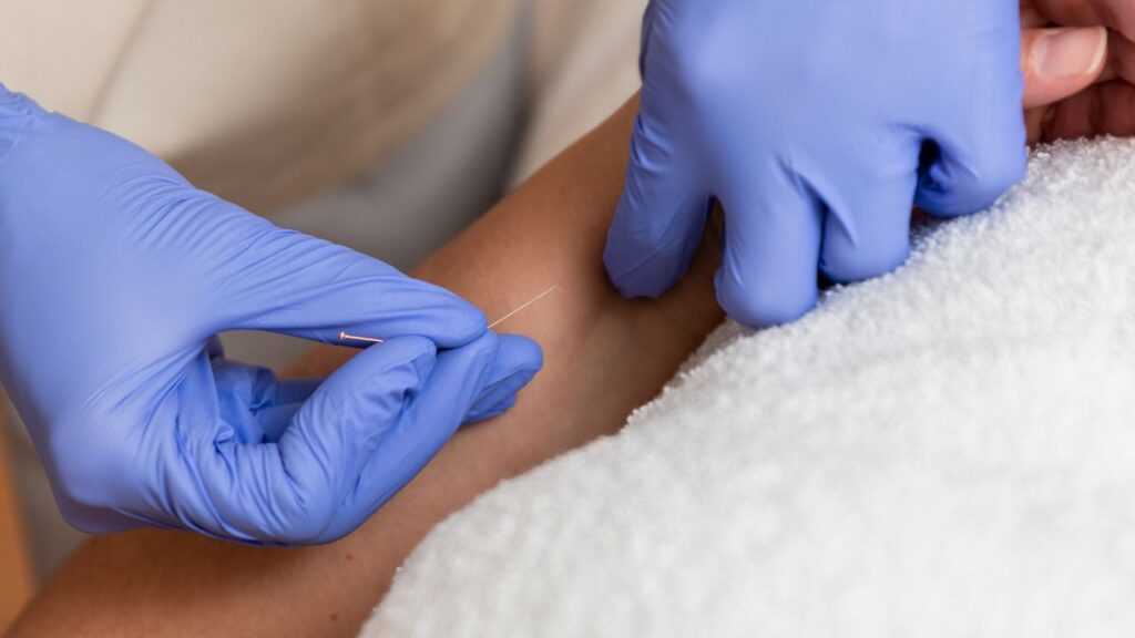 dry needling therapy that can help on seniors