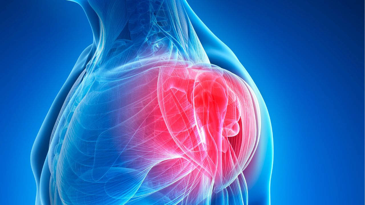 graphical representation of shoulder injury graphical representation of shoulder injury